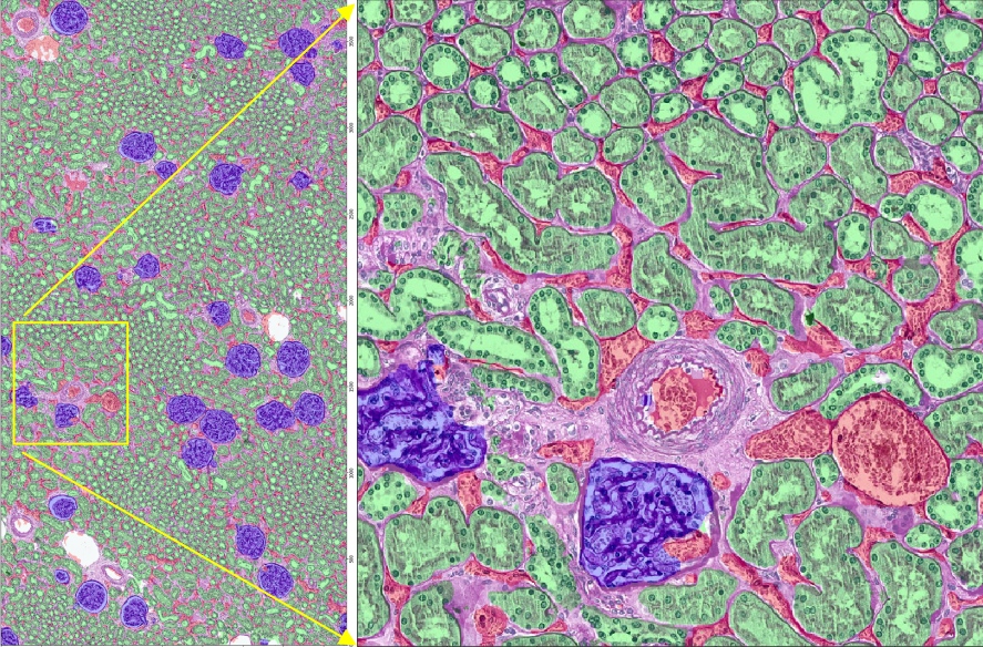 Whole-slide-image segmentation